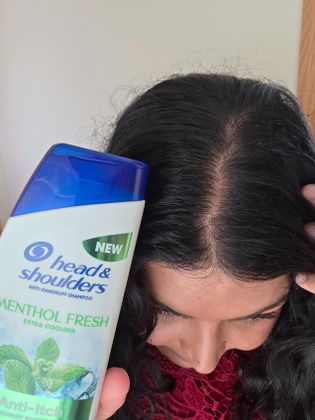 scalp feels fresh 
