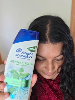 Scalp no flakes