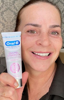Small coffee stains are becoming less visible—fantastic work Oral-B!