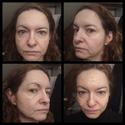 Avant et application du produit